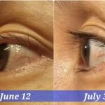 EYELASH AND EYEBROW MIRACLE GROWTH SERUM