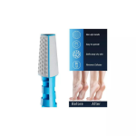 Pursonic 3 In 1 Callus Remover